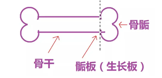 骨龄很关键，莫等骨骺闭合才望“个”兴叹