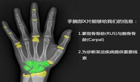 打生长激素到底能不能长高？看完这个就清楚了